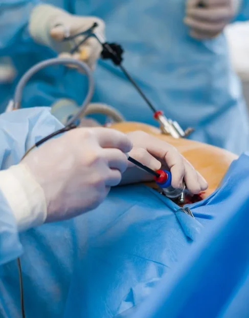 Advanced-Laparoscopy-1000x1000